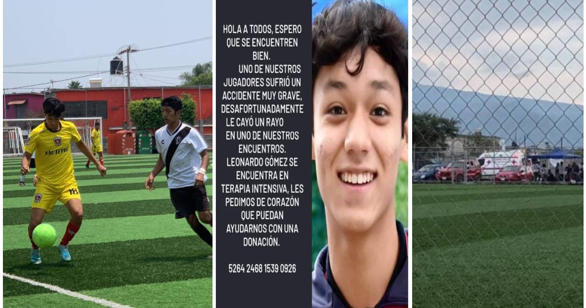 Piden ayuda para atender a 'Leo' el joven futbolista alcanzado por un rayo en Morelos